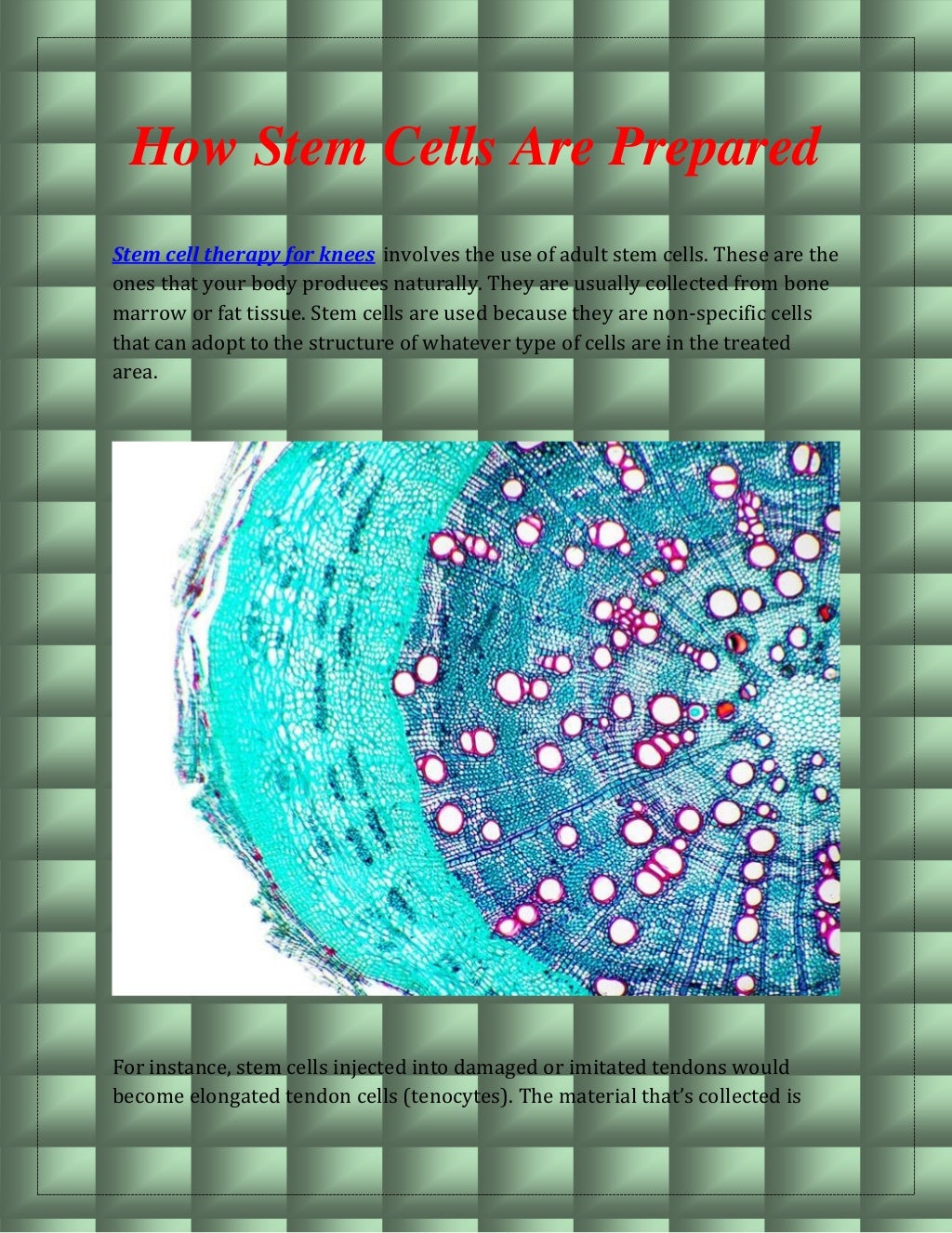 Stem Cell Therapy For Knees