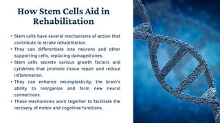 How Stem Cell Therapy is Transforming Stroke Rehabilitation | Dr. David ...