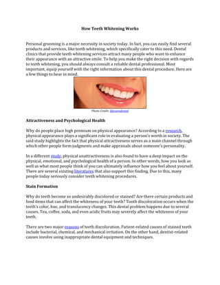 How Teeth Whitening Works
Personal grooming is a major necessity in society today. In fact, you can easily find several
products and services, like teeth whitening, which specifically cater to this need. Dental
clinics that provide teeth whitening services attract many people who want to enhance
their appearance with an attractive smile. To help you make the right decision with regards
to teeth whitening, you should always consult a reliable dental professional. Most
important, equip yourself with the right information about this dental procedure. Here are
a few things to bear in mind.
Photo Credit: lifecaredental
Attractiveness and Psychological Health
Why do people place high premium on physical appearance? According to a research,
physical appearance plays a significant role in evaluating a person’s worth in society. The
said study highlights the fact that physical attractiveness serves as a main channel through
which other people form judgments and make appraisals about someone’s personality.
In a different study, physical unattractiveness is also found to have a deep impact on the
physical, emotional, and psychological health of a person. In other words, how you look as
well as what most people think of you can ultimately influence how you feel about yourself.
There are several existing literatures that also support this finding. Due to this, many
people today seriously consider teeth whitening procedures.
Stain Formation
Why do teeth become so undesirably discolored or stained? Are there certain products and
food items that can affect the whiteness of your teeth? Tooth discoloration occurs when the
teeth’s color, hue, and translucency changes. This dental problem happens due to several
causes. Tea, coffee, soda, and even acidic fruits may severely affect the whiteness of your
teeth.
There are two major reasons of teeth discoloration. Patient-related causes of stained teeth
include bacterial, chemical, and mechanical irritation. On the other hand, dentist-related
causes involve using inappropriate dental equipment and techniques.
 