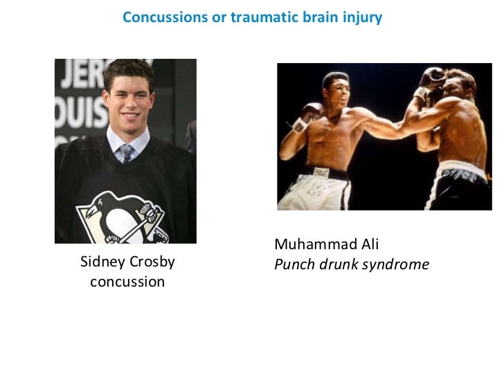 How the brain works and does not work Erin Legion Hall March 8 20…