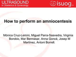 How to perform an amniocentesis 
Mónica Cruz-Lemini, Miguel Parra-Saavedra, Virginia 
Borobio, Mar Bennasar, Anna Goncé, Josep M 
Martínez, Antoni Borrell. 
 