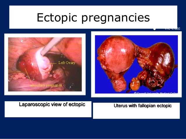 How to approch a case of bleeding in early pregnancy with case illust… How to approch a case of bleeding in early pregnancy with case illust…