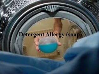 Detergent Allergy (soap)
 