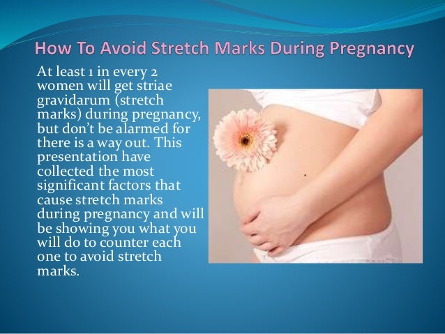 How to Avoid Stretch Marks During Pregnancy