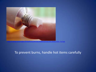 http://i.ehow.com/images/GlobalPhoto/Articles/5086522/treat-dry-hands-main_Full.jpgTo prevent burns, handle hot items carefully