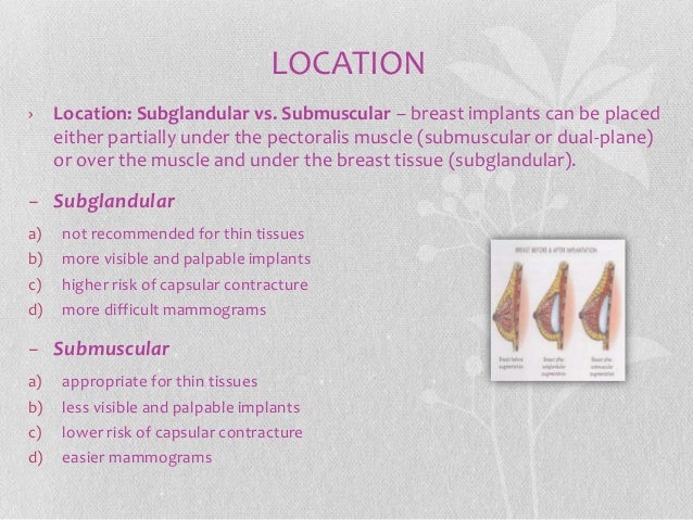 implant subglandular submuscular incision