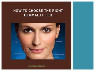 HOW TO CHOOSE THE RIGHT
     DERMAL FILLER




      www.imagesmedspa.com
 