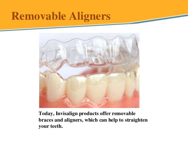 How to clean invisalign aligners? How to clean invisalign aligners?