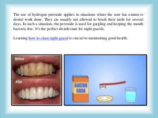 The use of hydrogen peroxide applies in situations where the user has extensive
dental work done. They are usually not allowed to brush their teeth for several
days. In such a situation, the peroxide is used for gargling and keeping the mouth
bacteria free. It’s the perfect disinfectant for night guards.
Learning how to clean night guard is crucial to maintaining good health.
 