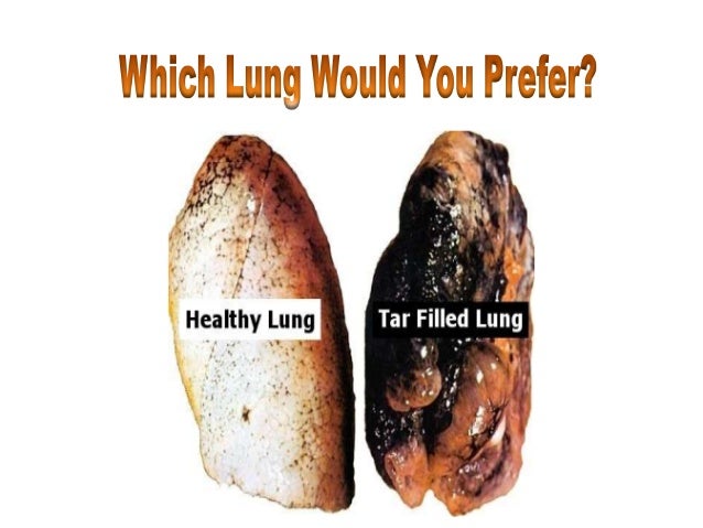How To Clean Your Lungs