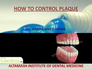 HOW TO CONTROL PLAQUE DR. AAKIFA JAVED ARIAN ALTAMASH INSTITUTE OF DENTAL MEDICINE 