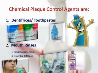 Mechanical Plaque Control Aids:2) Interdental Aids:Dental FlossTriangular Tooth PicksInterdental BrushesSuperflossPerio-Aid1) ToothBrushes:Manual ToothbrushElectrical Toothbrush4) Others:Gauze StripsPipe Cleanserswater Irrigation Device3) Aids for Gingival Stimulation:Rubber Tip Stimulator5) Aids for Completely or Partially Edentulous Patients:Denture & Partial Clasp BrushesCleansing Solutions