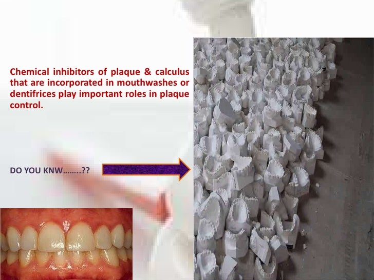 How to control plaque