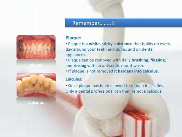 How to control plaque with chemicals