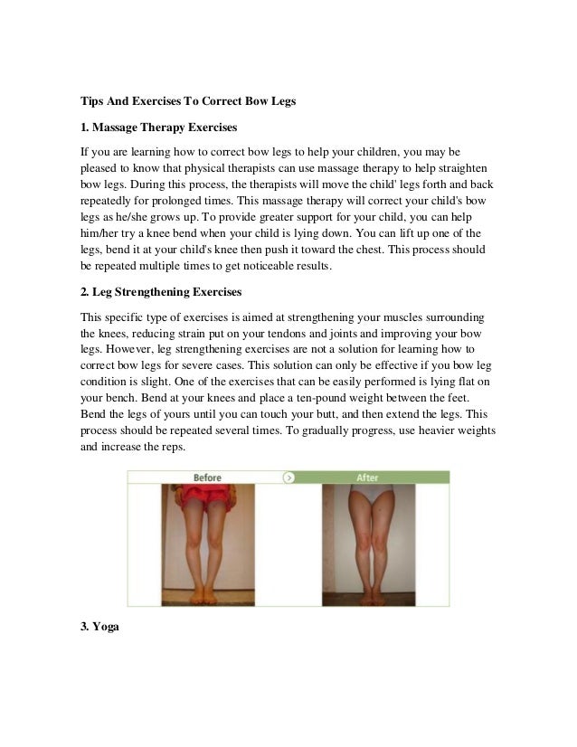 Learn How To Correct Bow Legs With Bow Legs Exercises