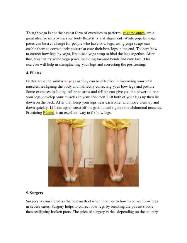 Learn How To Correct Bow Legs With Bow Legs Exercises