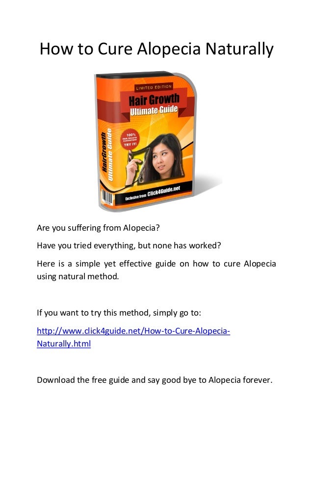 How To Cure Alopecia Naturally