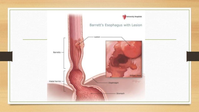 Natural Therapy To Cure Cancer Natural Therapy To Cure Cancer