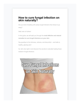 How to cure fungal infection on
skin naturally?
Are you tired of dealing with pesky fungal infections that refuse to go
away?
Well, look no further!
In this guide, we will walk you through the most effective and natural
remedies to cure fungal infections on your skin.
Say goodbye to the itchiness, redness, and discomfort – and hello to
healthy, glowing skin!
So, let's dive right in and discover the secrets to naturally healing those
stubborn fungal infections.
 