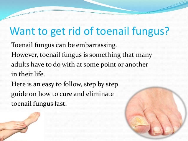 How to cure toenail fungus quickly