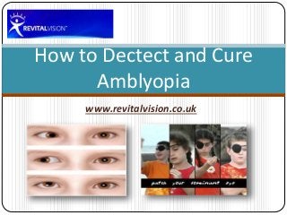 How to Dectect and Cure 
Amblyopia 
www.revitalvision.co.uk 
 