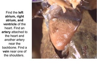 Find the left
atrium, right
atrium, and
ventricle of the
heart. Find an
artery attached to
the heart and
another artery
near the
backbone. Find a
vein near one of
the shoulders.
 