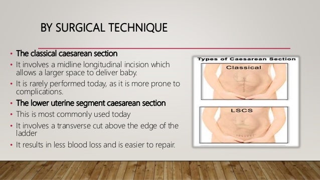 HOW TO DO A CESAREAN SECTION, EVIDENCE BASED By DR DELE - 638x359 - jpeg C Section Technique