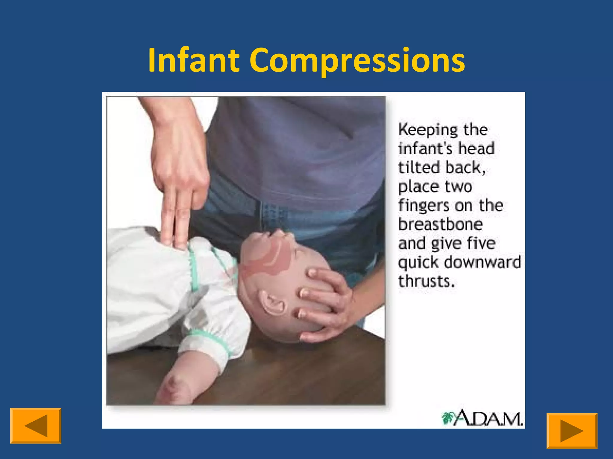 Infant Compressions
 