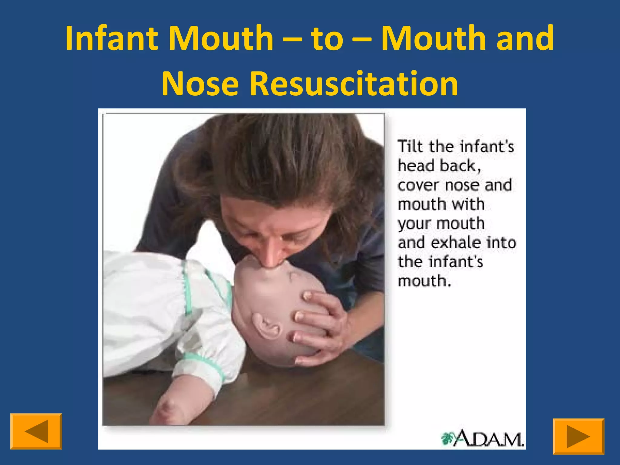 Infant Mouth – to – Mouth and
      Nose Resuscitation
 