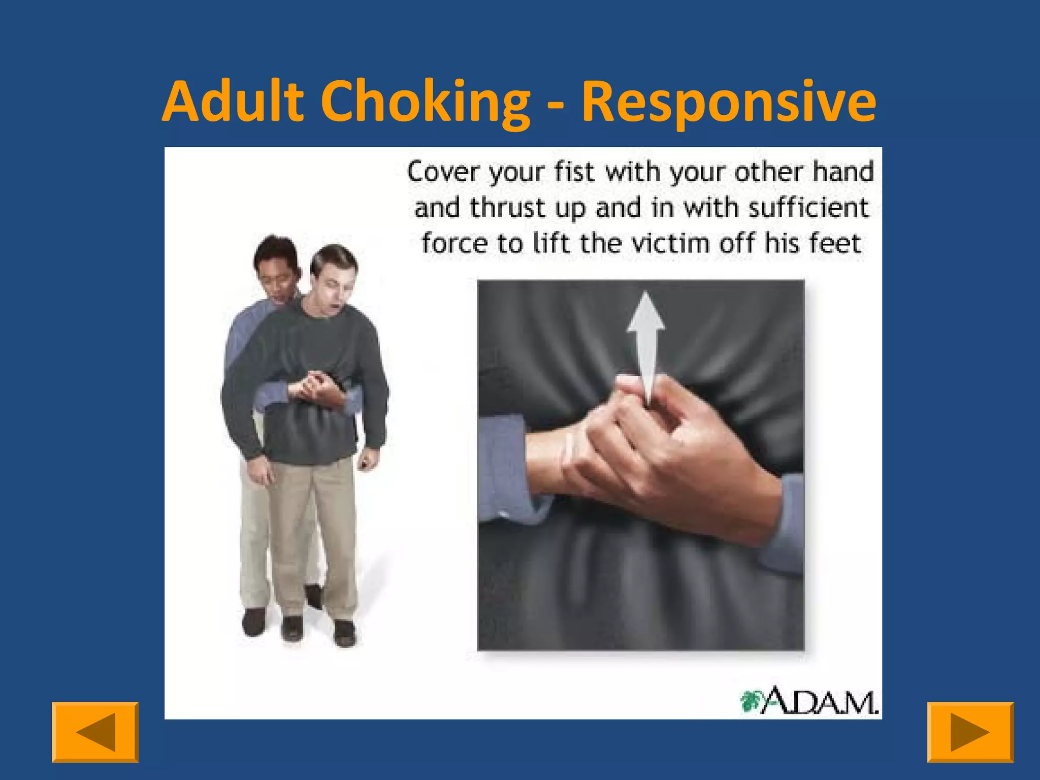 Adult Choking - Responsive




               1/2 way
            between navel
             and xyphoid
 