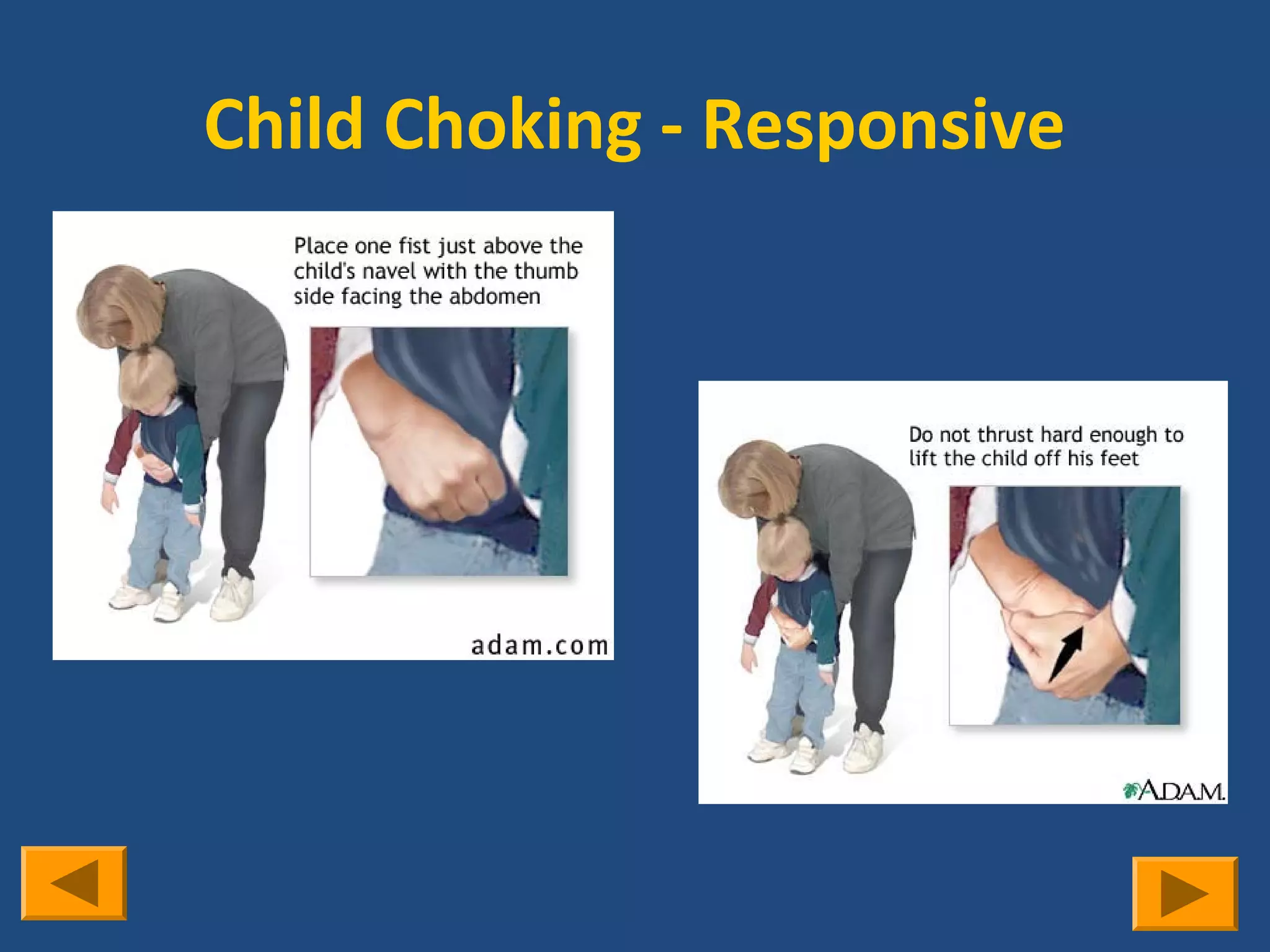 Child Choking - Responsive
 