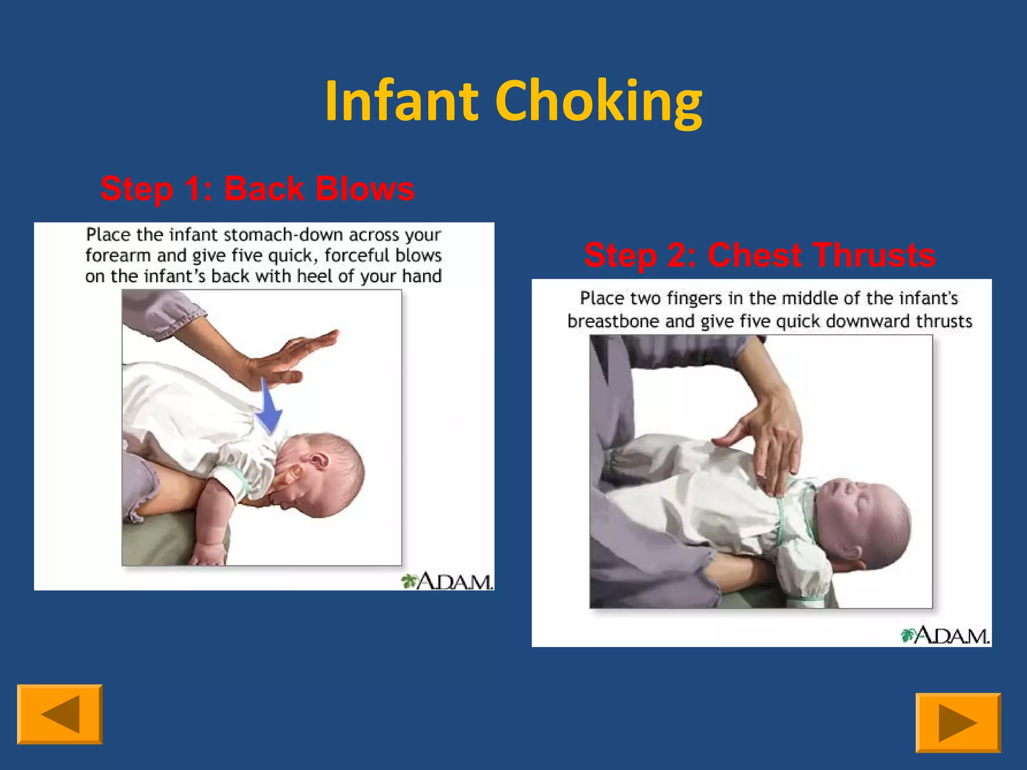 Infant Choking
Step 1: Back Blows
                     Step 2: Chest Thrusts
 