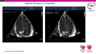 How to echo series...LV systolic function-practical assessment | PPTX