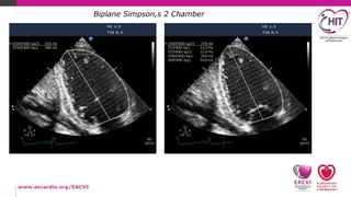 How to echo series...LV systolic function-practical assessment | PPTX