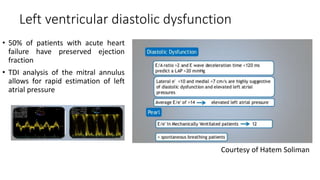 Left ventricular diastolic dysfunction
• 50% of patients with acute heart
failure have preserved ejection
fraction
• TDI analysis of the mitral annulus
allows for rapid estimation of left
atrial pressure
Courtesy of Hatem Soliman
 