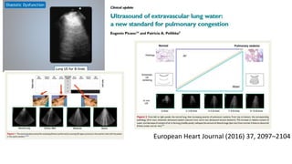 European Heart Journal (2016) 37, 2097–2104
 