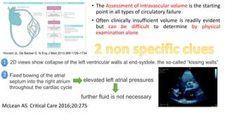 Vincent JL, De Backer D. N Eng J Med 2013;369:1726–1734
• The Assessment of intravascular volume is the starting
point in all types of circulatory failure
• Often clinically insufficient volume is readily evident
but can be difficult to determine by physical
examination alone
2D views show collapse of the left ventricular walls at end‐systole, the so‐called “kissing walls”
further fluid is not necessary
Fixed bowing of the atrial
septum into the right atrium
throughout the cardiac cycle
elevated left atrial pressures
1
2
McLean AS. Critical Care 2016;20:275
 