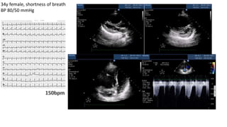 34y female, shortness of breath
BP 80/50 mmHg
 