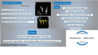 ObstructionHypotension
Inotropes
Inotropes
Courtesy of Hatem Soliman
 