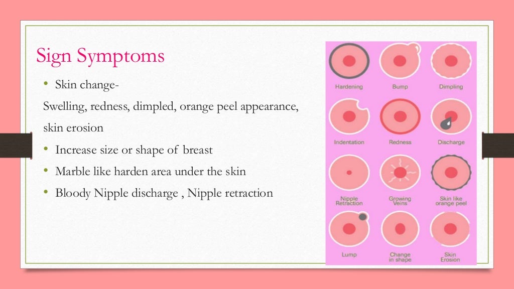 How to evaluation of breast lump
