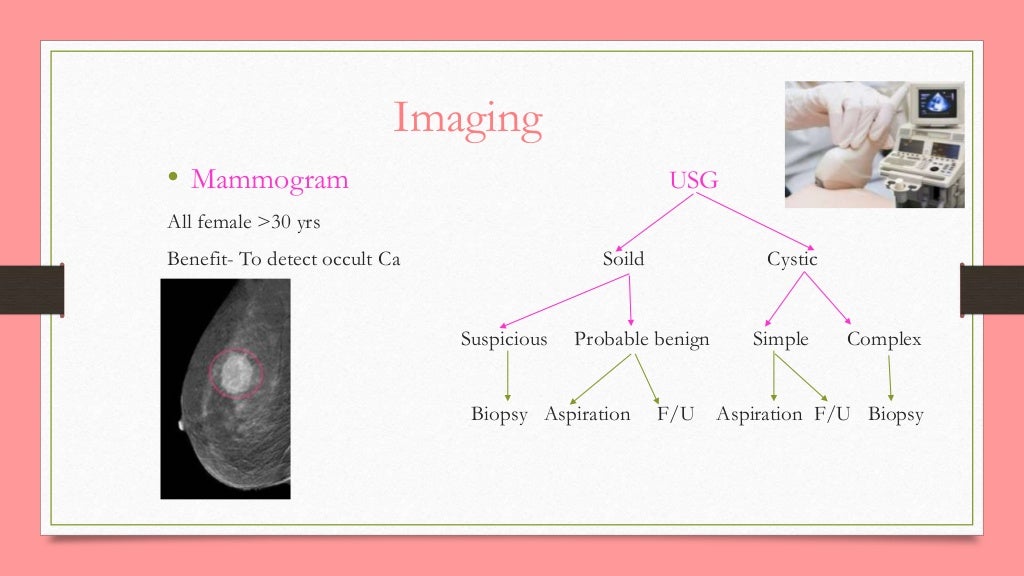 How to evaluation of breast lump