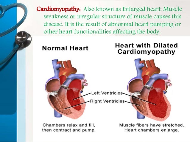 Find the top best cardiologist in Hyderabad