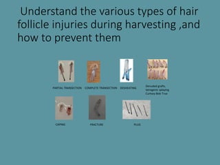 Understand the various types of hair
follicle injuries during harvesting ,and
how to prevent them
PARTIAL TRANSECTION COMP...