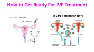 How to Get Ready For IVF Treatment
 