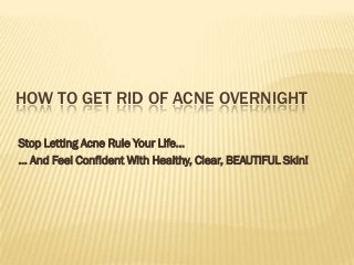 HOW TO GET RID OF ACNE OVERNIGHT

Stop Letting Acne Rule Your Life...
... And Feel Confident With Healthy, Clear, BEAUTIFUL Skin!
 