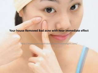 Your house Removed Bad acne with near immediate effect


       http://www.howtogetridofapimplesovernight.com/
 