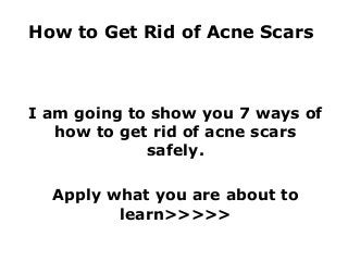 How to Get Rid of Acne Scars



I am going to show you 7 ways of
   how to get rid of acne scars
             safely.

  Apply what you are about to
         learn>>>>>
 