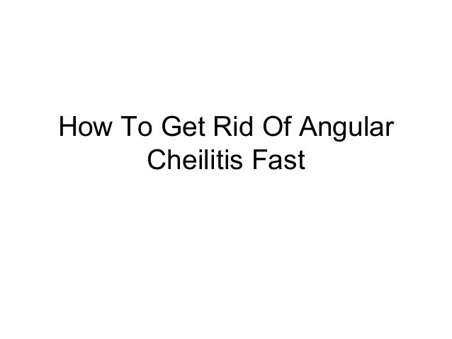 How To Get Rid Of Angular Cheilitis Fast