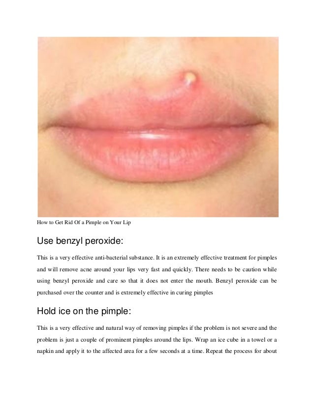 reasons you can get pimples on your vag lips