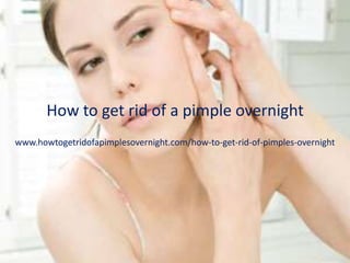 How to get rid of a pimple overnight
www.howtogetridofapimplesovernight.com/how-to-get-rid-of-pimples-overnight
 
